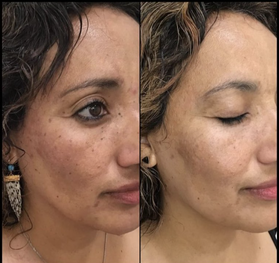 Before treatment - Client 3